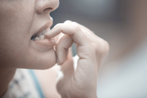 Bad-habit-to-avoid-for-dental-bonding