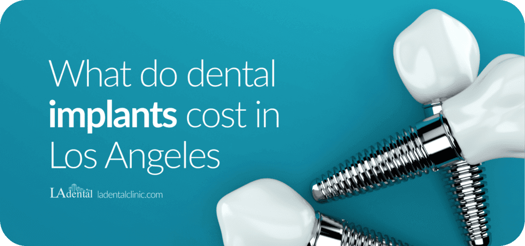 dental-implants-cost-blog-post-989-464_x1.5 (1)