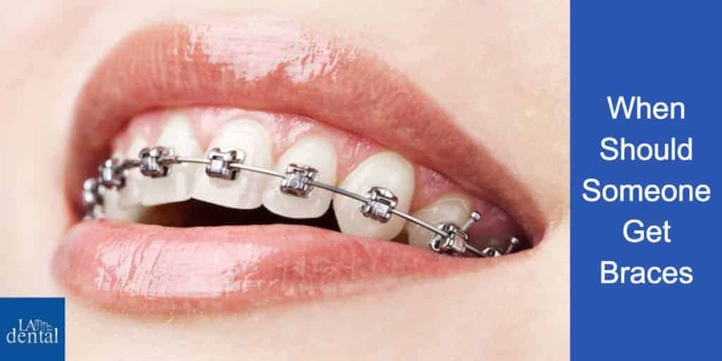 When Should Someone Get Braces