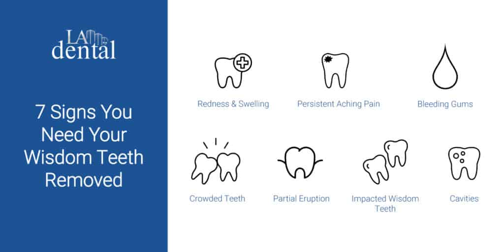 wisdom teeth signs