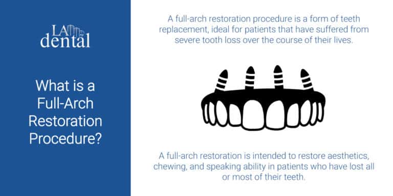 What-is-a-Full-Arch-Restoration-Procedure