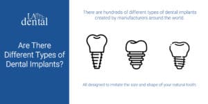 Are there different types of dental implants-01