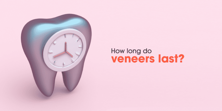How long do veneers last?