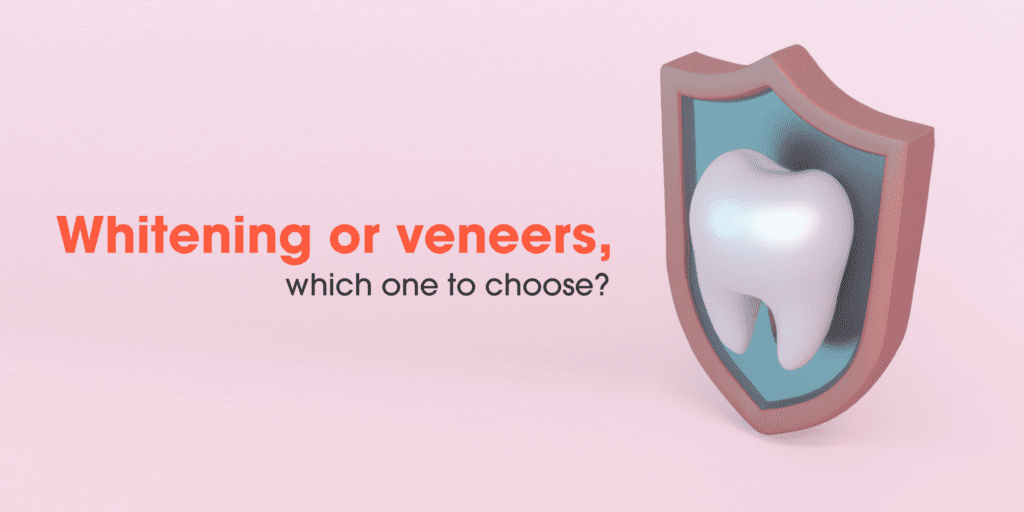 teeth whitening vs veneers