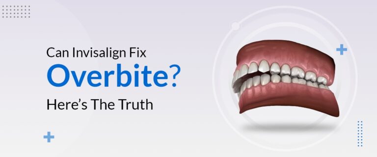 Can Invisalign Fix Overbite? Here’s The Truth