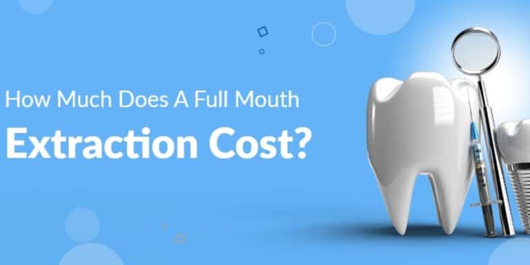 How Much Does A Full Mouth Extraction Cost?