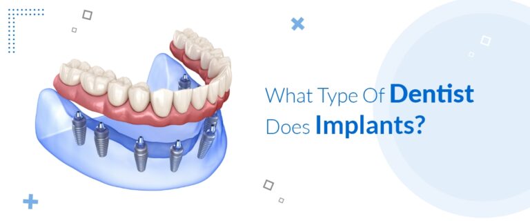 What Type Of Dentist Does Implants?