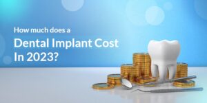 How Much Does ADental Implant CostIn 2023