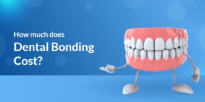 How Much DoesDental Bonding Cost