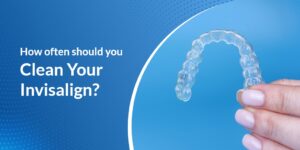 How OftenShould You CleanYour Invisalign