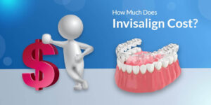 How Much Does Invisalign Cost?