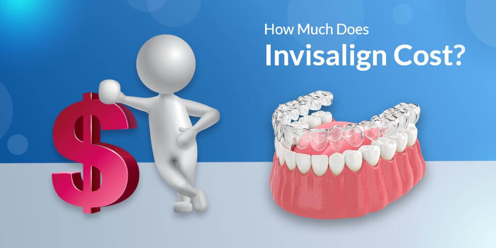 How Much Does Invisalign Cost? - LA Dental Clinic