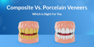 Composite Vs. Porcelain Veneers: Which Is Right For You?