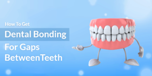 How To Get Dental Bonding For Gaps Between Teeth