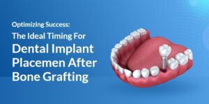 Optimizing-Success-The-Ideal-Timing-For-Dental-Implant-Placement-After-Bone-Grafting-1