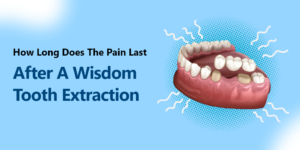 How Long Does The Pain Last After A Wisdom Tooth Extraction?