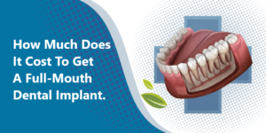 How Much Does It Cost To Get A Full-Mouth Dental Implant?