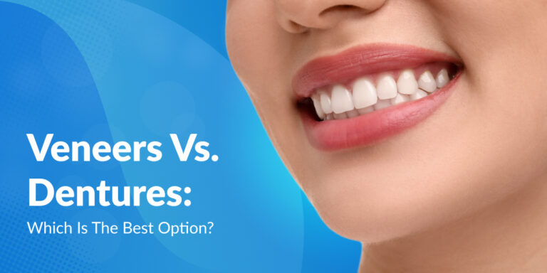 Veneers Vs. Dentures: Which Is The Best Option?