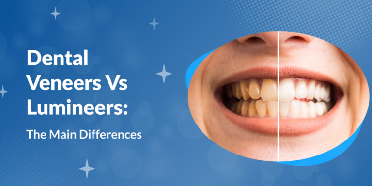 Dental Veneers Vs. Lumineers: The Main Differences