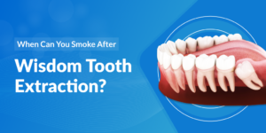 When Can You Smoke After Wisdom Tooth Extraction?