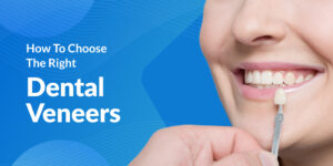 How To Choose The Right Dental Veneers