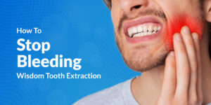 How To Stop Bleeding After Wisdom Tooth Extraction