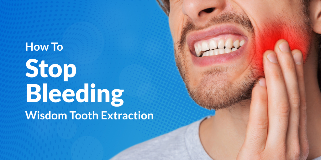 How To Stop Bleeding After Wisdom Tooth Extraction - LA Dental Clinic