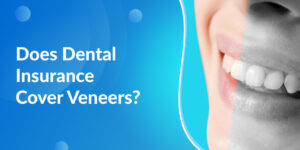 Does Dental Insurance Cover Veneers?