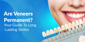 Are Veneers Permanent? Your Guide To Long-Lasting Smiles