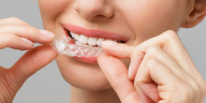 Can You Wear Invisalign Only At Night?